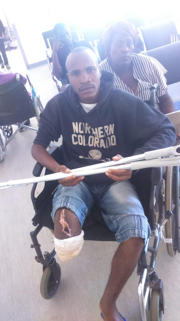  Family photo of Morris Mukunga, a public bus driver, whom uniformed soldiers shot on January 20, 2019 in the Budiriro suburb of Harare. Mukunga’s right leg was later amputated