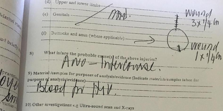 تقرير طبي كتبه طبيب في كمبالا بأوغندا، بعد إجرائه فحص شرج قسري لرجل يشتبه في سلوكه الجنسي المثلي التوافقي.