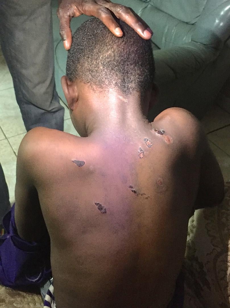 Ce talibé de 9 ans était recroquevillé de douleur quand il a été aperçu à la station de bus de Saint-Louis à une heure du matin, le 2 mai 2017. 